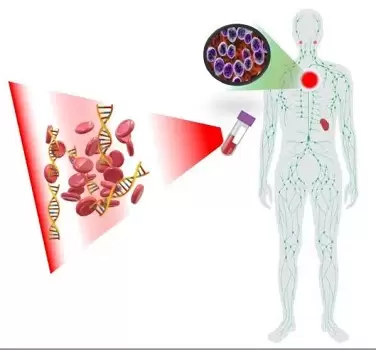 Liquid biopsy